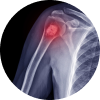 Musculoskeletal Oncology-img
